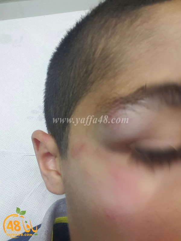 kid hit cars (3).jpg